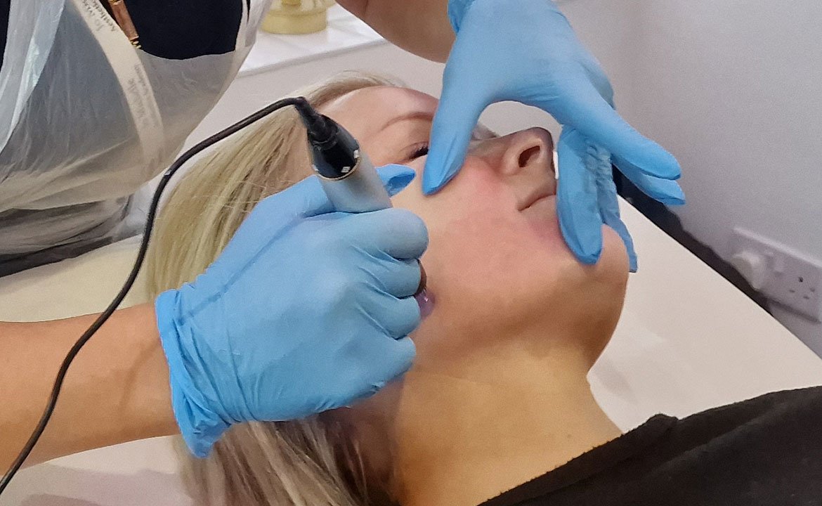 NIAA_Microneedling_360_tc